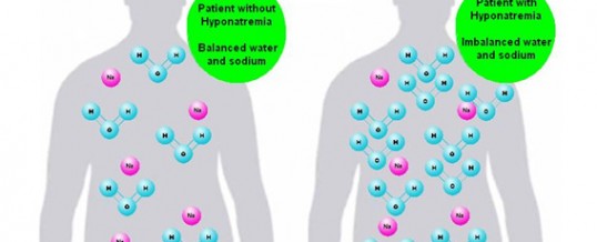 Hyponatremia Is There Such A Thing As Too Much Water Aquaid Uk